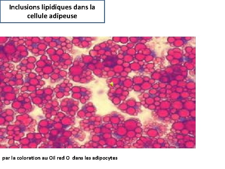 Inclusions lipidiques dans la cellule adipeuse par la coloration au Oil red O dans