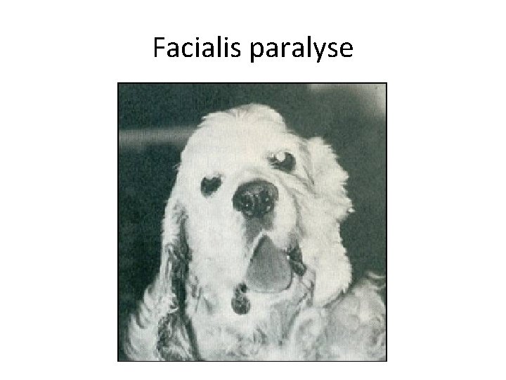 Facialis paralyse 