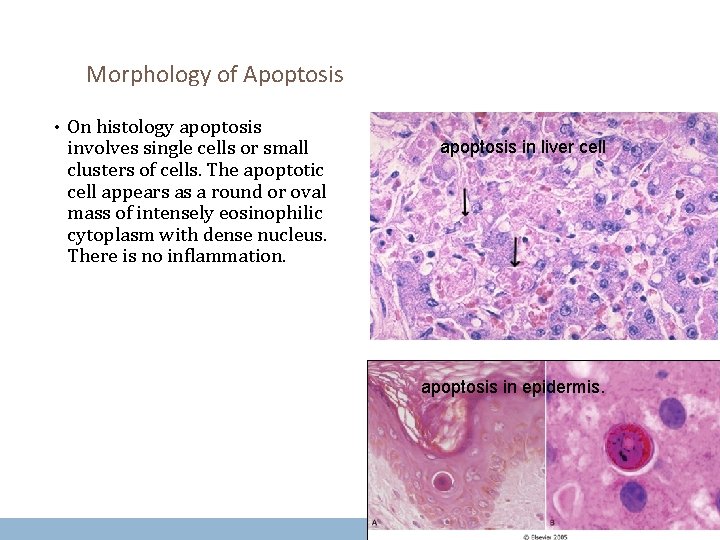 Morphology of Apoptosis • On histology apoptosis involves single cells or small clusters of