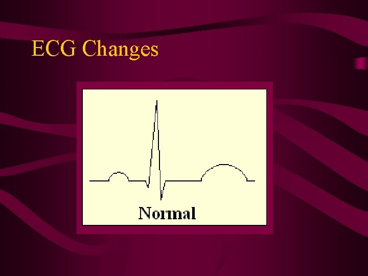 ECG Changes 