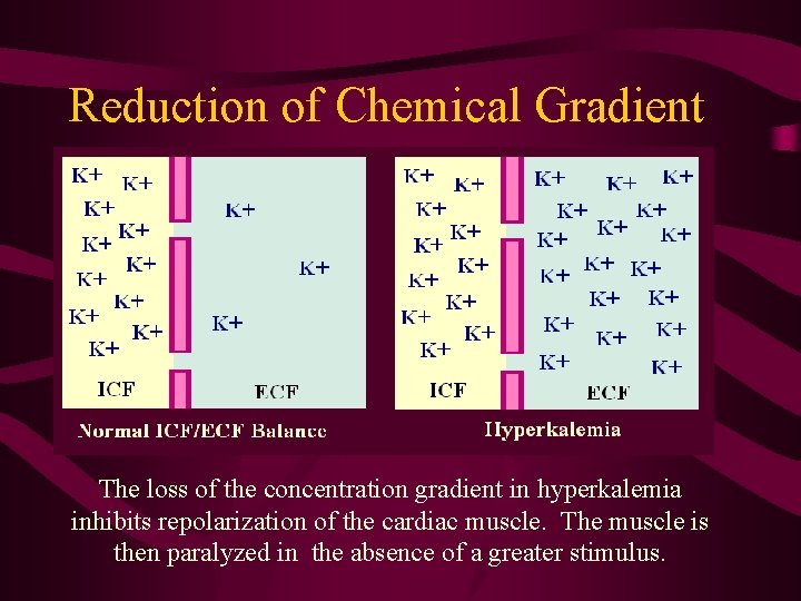 Reduction of Chemical Gradient The loss of the concentration gradient in hyperkalemia inhibits repolarization