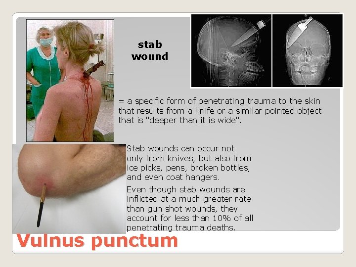 stab wound = a specific form of penetrating trauma to the skin that results