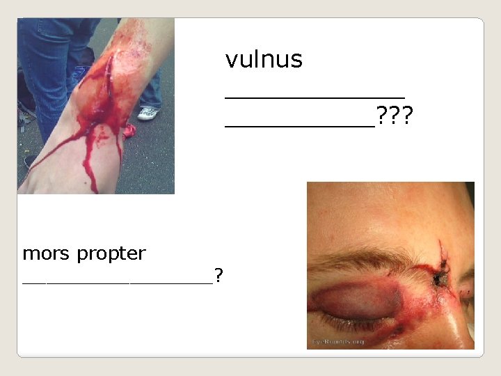 vulnus ______? ? ? mors propter ________? 