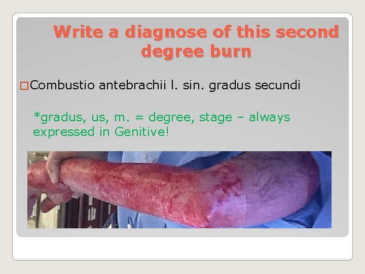 Write a diagnose of this second degree burn � Combustio antebrachii l. sin. gradus