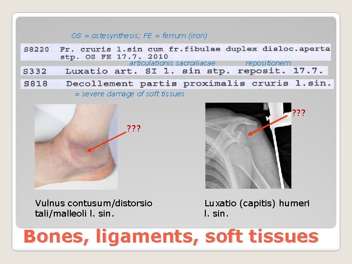 OS = ostesynthesis; FE = ferrum (iron) articulationis sacroiliacae repositionem = severe damage of