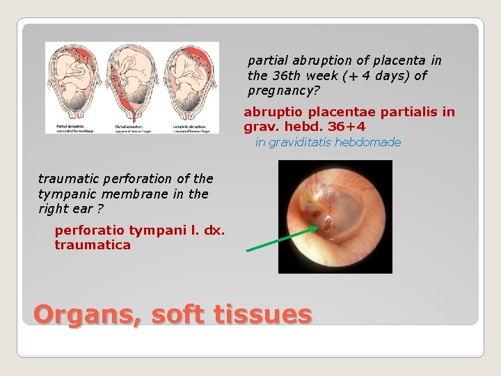 partial abruption of placenta in the 36 th week (+ 4 days) of pregnancy?