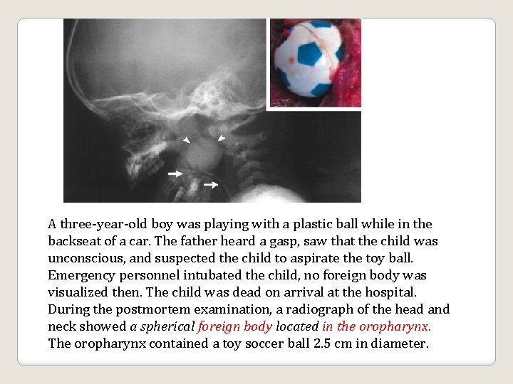 A three-year-old boy was playing with a plastic ball while in the backseat of