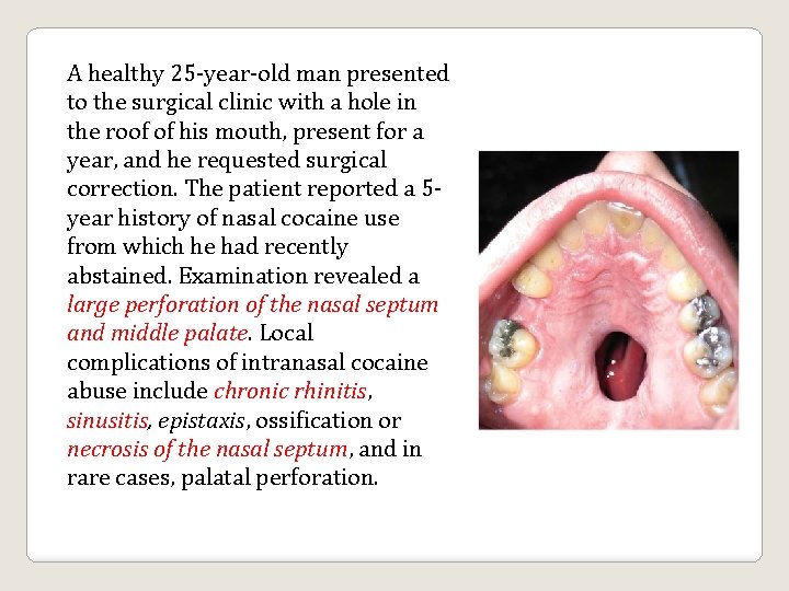 A healthy 25 -year-old man presented to the surgical clinic with a hole in