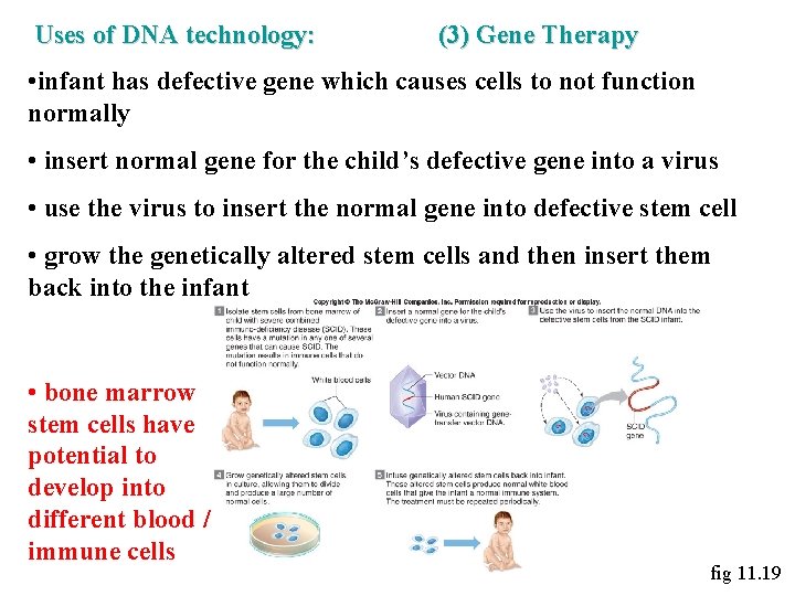 Uses of DNA technology: (3) Gene Therapy • infant has defective gene which causes