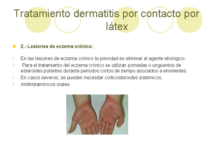 Tratamiento dermatitis por contacto por látex l 2. - Lesiones de eczema crónico: •