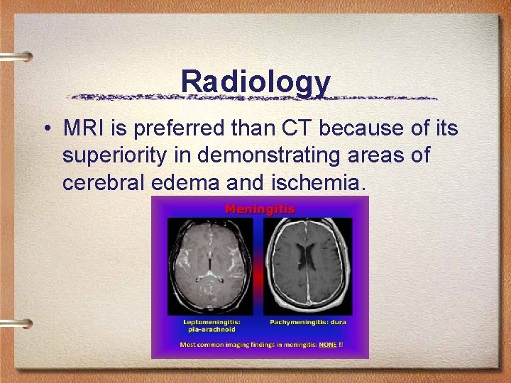 Radiology • MRI is preferred than CT because of its superiority in demonstrating areas