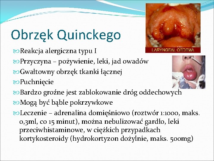 Obrzęk Quinckego Reakcja alergiczna typu I Przyczyna – pożywienie, leki, jad owadów Gwałtowny obrzęk