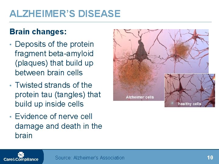 ALZHEIMER’S DISEASE Brain changes: • Deposits of the protein fragment beta-amyloid (plaques) that build