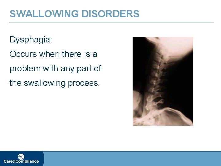 SWALLOWING DISORDERS Dysphagia: Occurs when there is a problem with any part of the