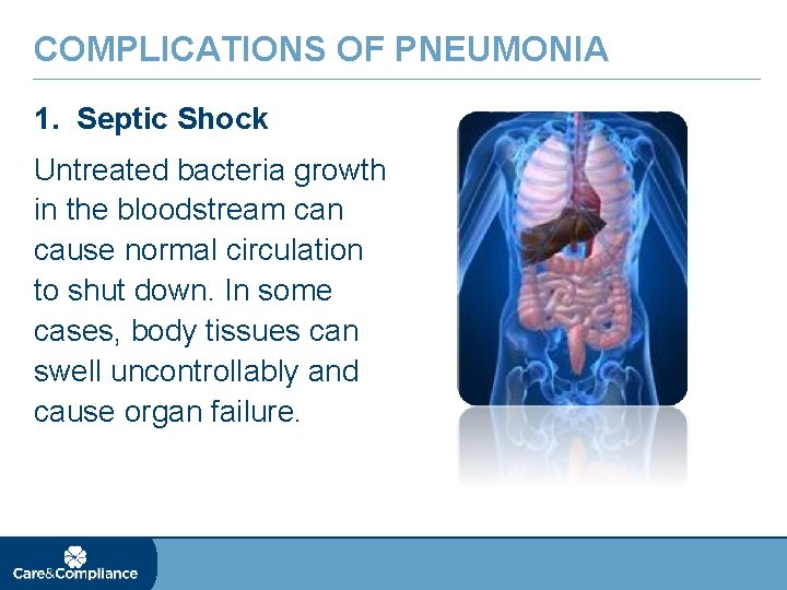 COMPLICATIONS OF PNEUMONIA 1. Septic Shock Untreated bacteria growth in the bloodstream can cause