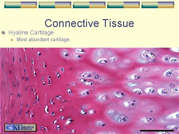 Connective Tissue Hyaline Cartilage l Most abundant cartilage. 