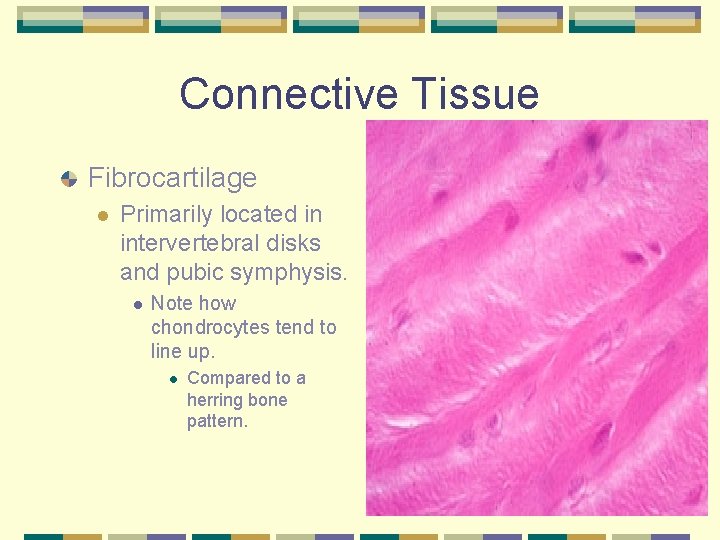 Connective Tissue Fibrocartilage l Primarily located in intervertebral disks and pubic symphysis. l Note