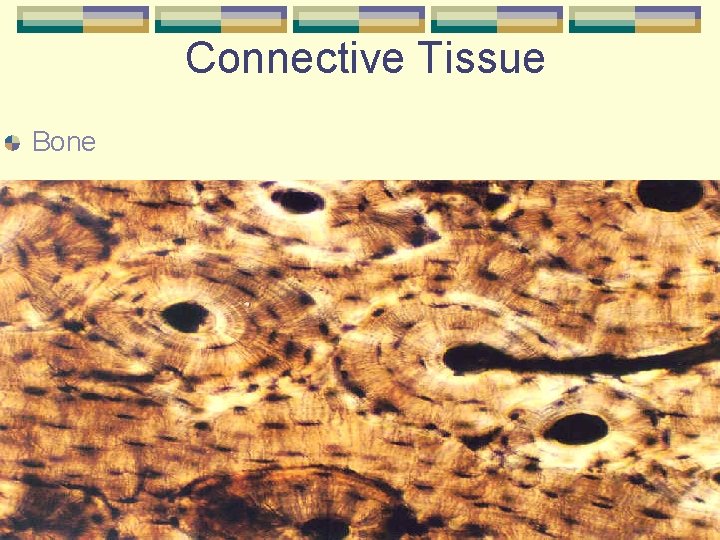 Connective Tissue Bone 