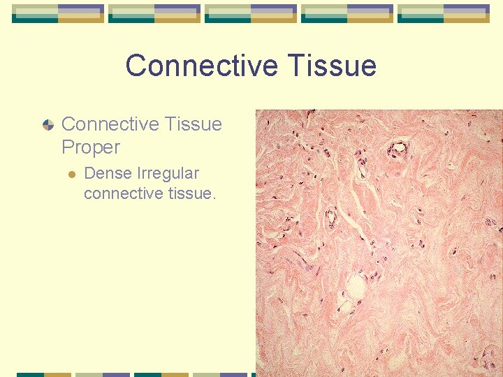 Connective Tissue Proper l Dense Irregular connective tissue. 