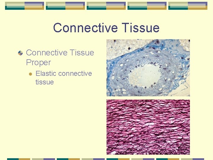 Connective Tissue Proper l Elastic connective tissue 