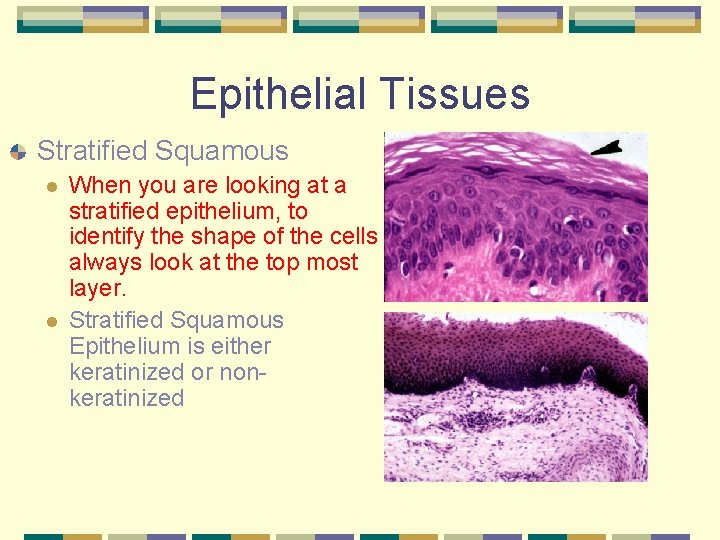 Epithelial Tissues Stratified Squamous l l When you are looking at a stratified epithelium,