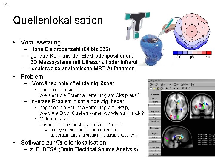 14 Quellenlokalisation • Voraussetzung – Hohe Elektrodenzahl (64 bis 256) – genaue Kenntnis der