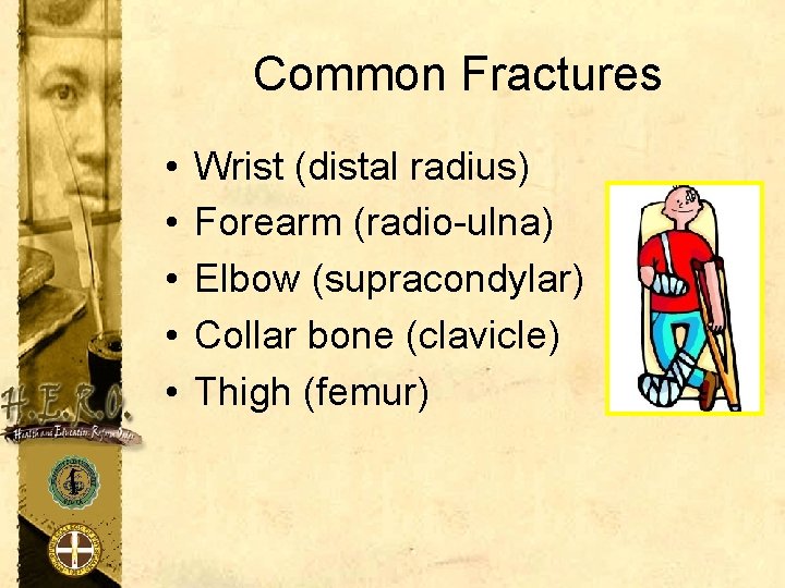 Common Fractures • • • Wrist (distal radius) Forearm (radio-ulna) Elbow (supracondylar) Collar bone