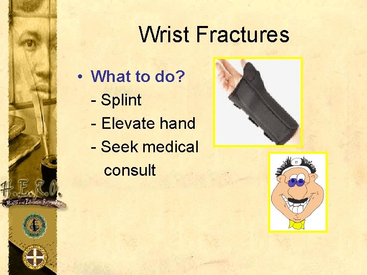 Wrist Fractures • What to do? - Splint - Elevate hand - Seek medical