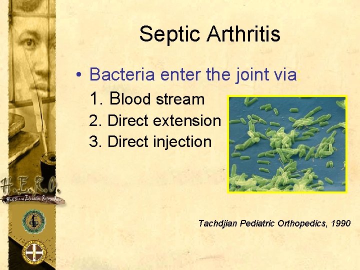 Septic Arthritis • Bacteria enter the joint via: 1. Blood stream 2. Direct extension