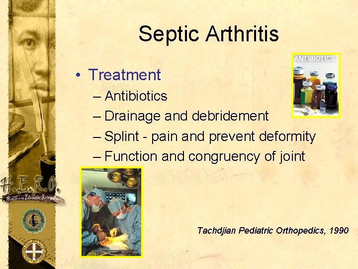 Septic Arthritis • Treatment – Antibiotics – Drainage and debridement – Splint - pain