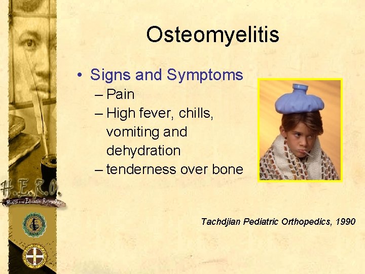 Osteomyelitis • Signs and Symptoms – Pain – High fever, chills, vomiting and dehydration