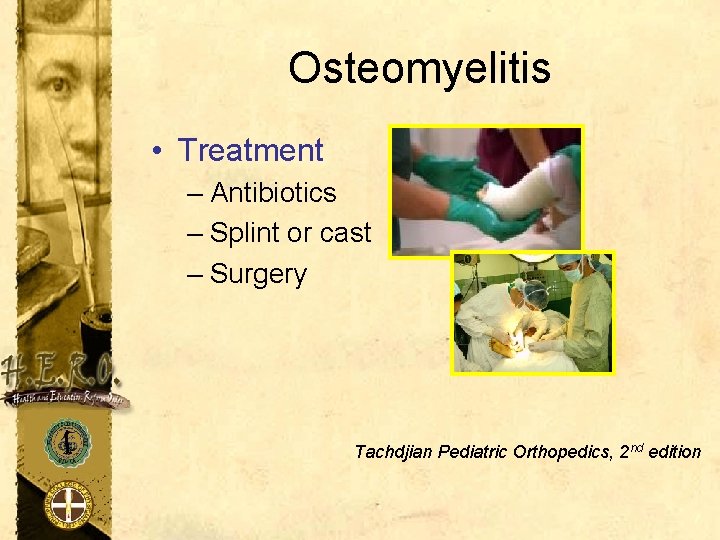 Osteomyelitis • Treatment – Antibiotics – Splint or cast – Surgery Tachdjian Pediatric Orthopedics,