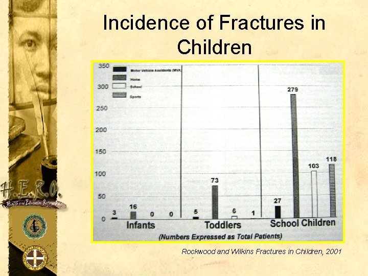 Incidence of Fractures in Children Rockwood and Wilkins Fractures in Children, 2001 