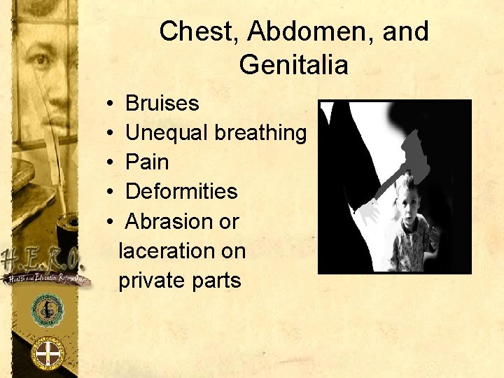 Chest, Abdomen, and Genitalia • • • Bruises Unequal breathing Pain Deformities Abrasion or