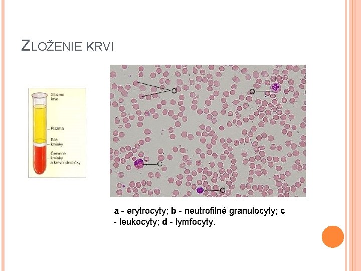 ZLOŽENIE KRVI a - erytrocyty; b - neutrofilné granulocyty; c - leukocyty; d -