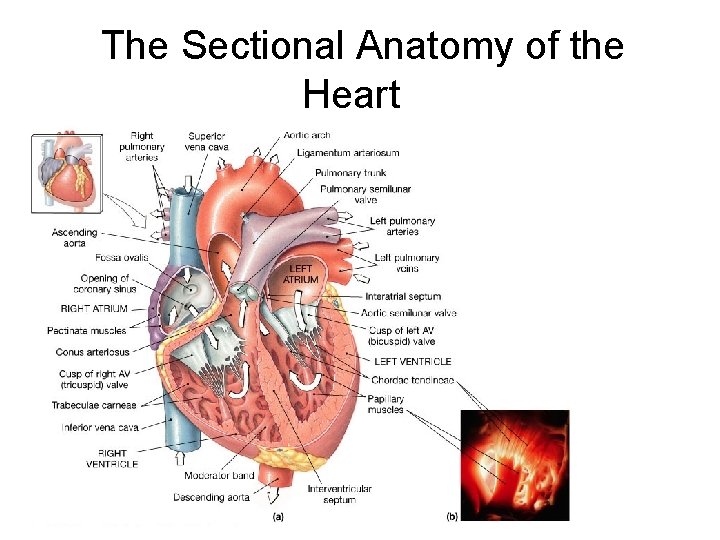The Sectional Anatomy of the Heart 