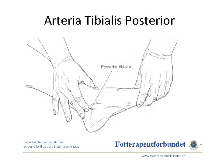 Arteria Tibialis Posterior 