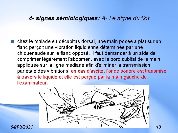 4 - signes sémiologiques: A- Le signe du flot n chez le malade en