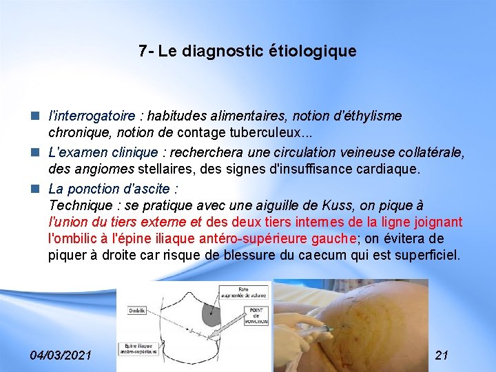 7 - Le diagnostic étiologique n l'interrogatoire : habitudes alimentaires, notion d'éthylisme chronique, notion