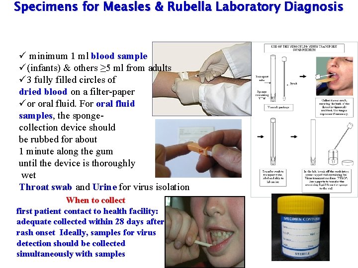 Specimens for Measles & Rubella Laboratory Diagnosis ü minimum 1 ml blood sample ü(infants)