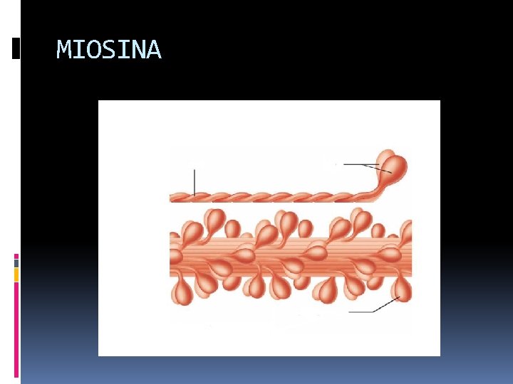 MIOSINA 