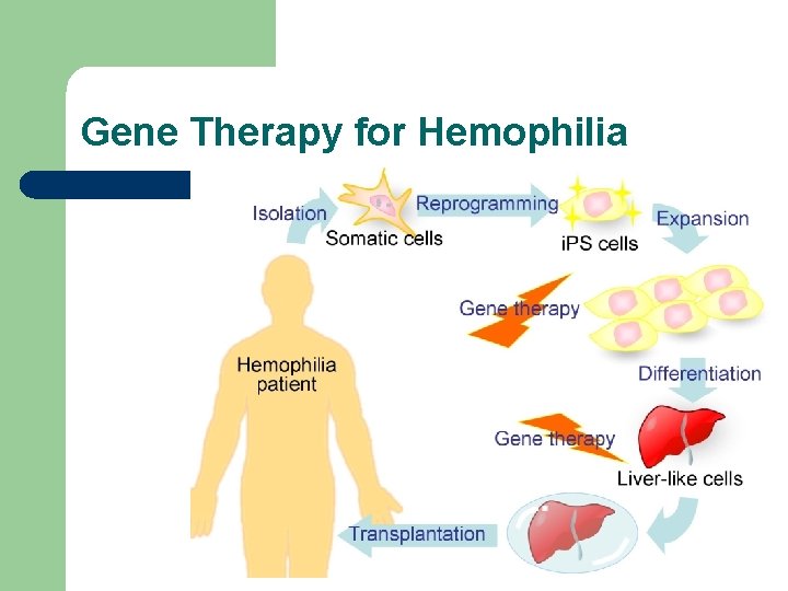 Gene Therapy for Hemophilia 