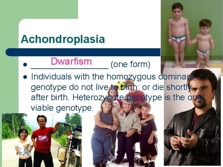 Achondroplasia l l Dwarfism ________ (one form) Individuals with the homozygous dominant genotype do