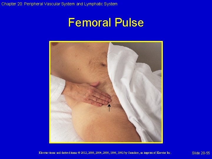 Chapter 20: Peripheral Vascular System and Lymphatic System Femoral Pulse Elsevier items and derived