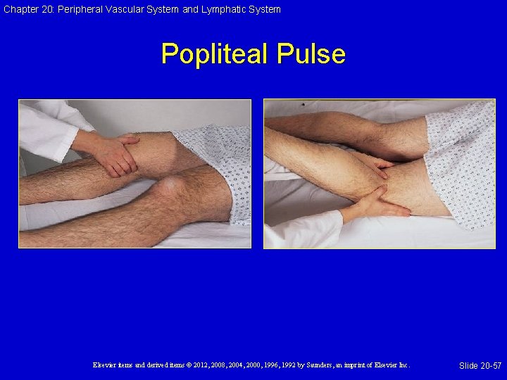 Chapter 20: Peripheral Vascular System and Lymphatic System Popliteal Pulse Elsevier items and derived