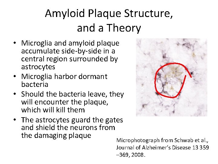 Amyloid Plaque Structure, and a Theory • Microglia and amyloid plaque accumulate side-by-side in