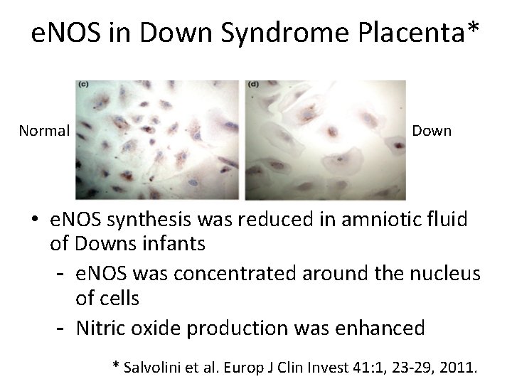 e. NOS in Down Syndrome Placenta* Normal Down • e. NOS synthesis was reduced