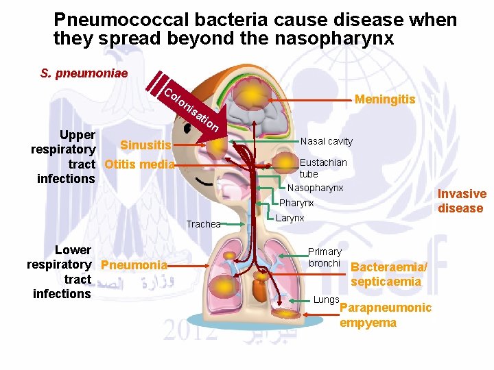 Pneumococcal bacteria cause disease when they spread beyond the nasopharynx S. pneumoniae Co lo