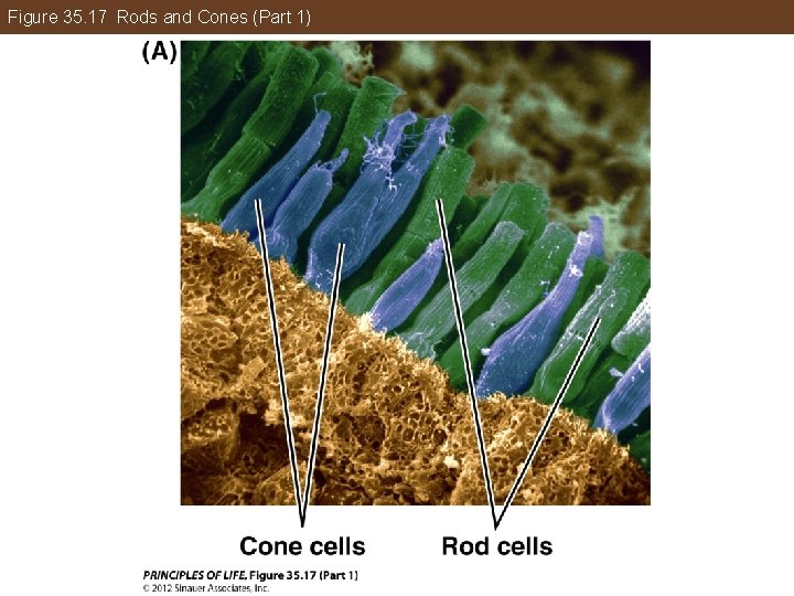 Figure 35. 17 Rods and Cones (Part 1) 