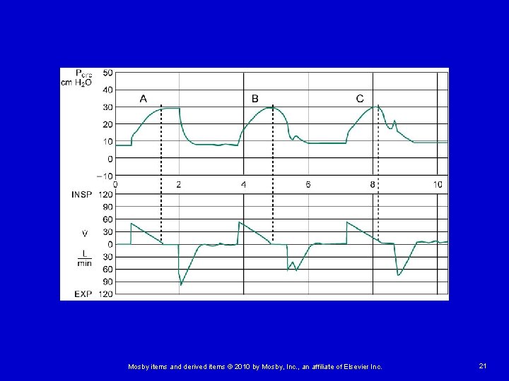 Mosby items and derived items © 2010 by Mosby, Inc. , an affiliate of